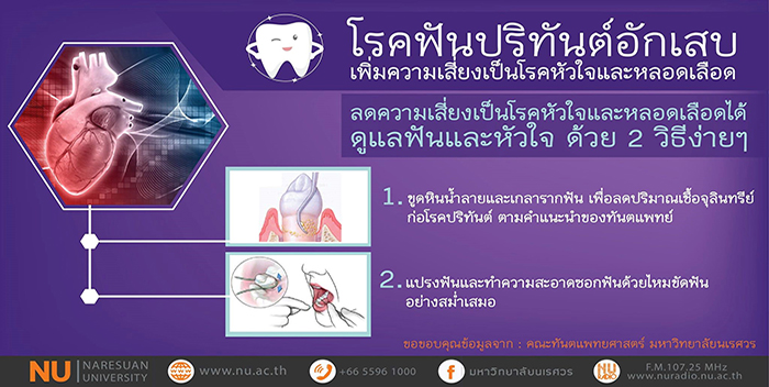 2 วิธีง่ายๆ ดูแลฟัน ป้องกันโรคหัวใจและหลอดเลือด